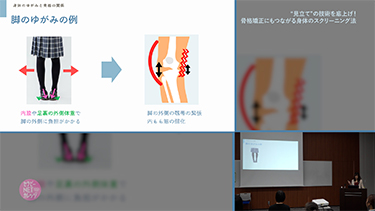 佐々木千紘の“見立て”の技術を底上げ!骨格矯正にもつながる身体のスクリーニング法
